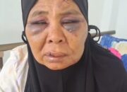 Nenek Dianiaya Pekerja Tambang Ilegal di Pasaman, LBH Padang Bertindak!