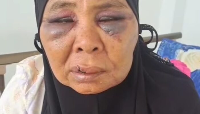 Nenek Dianiaya Pekerja Tambang Ilegal di Pasaman, LBH Padang Bertindak!